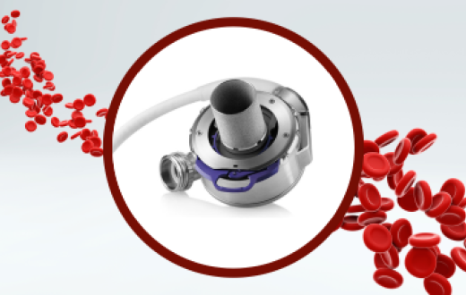 Avanço inédito: primeiro implante de coração artificial do interior de SP